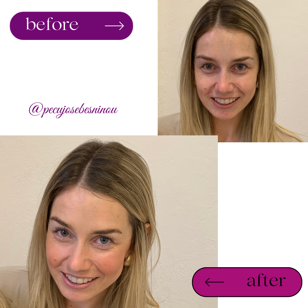 Black White Minimalist Hair Beauty Before After Instagram Post (3)