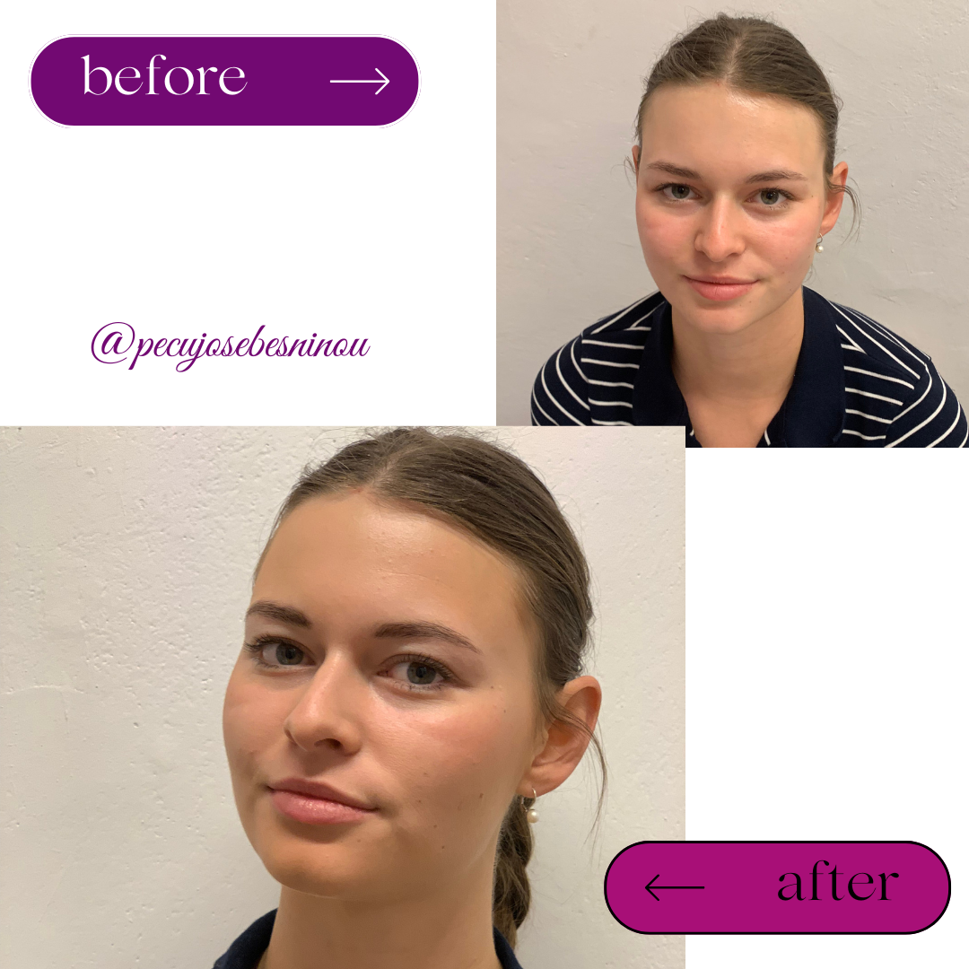 Black White Minimalist Hair Beauty Before After Instagram Post (5)